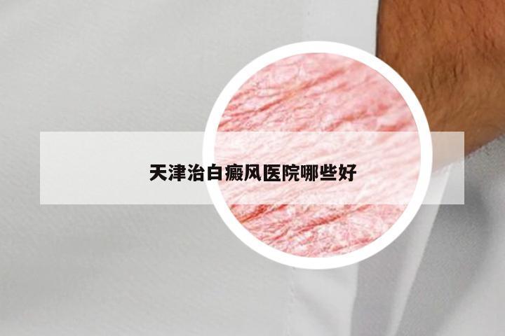 天津治白癜风医院哪些好