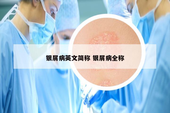 银屑病英文简称 银屑病全称