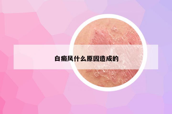 白癜风什么原因造成的