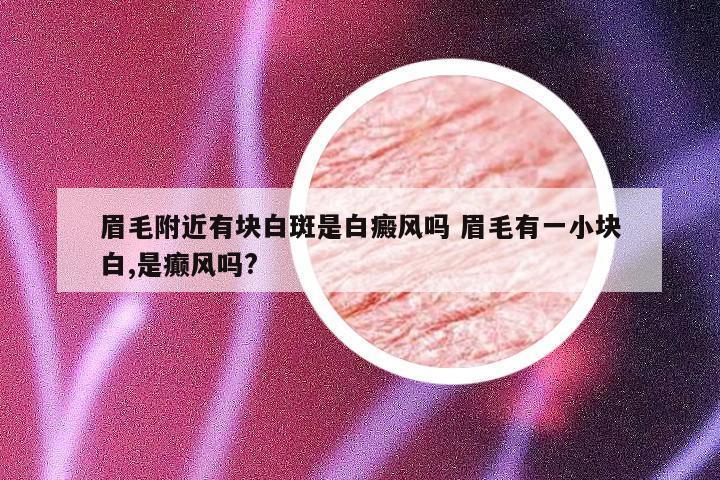 眉毛附近有块白斑是白癜风吗 眉毛有一小块白,是癫风吗?
