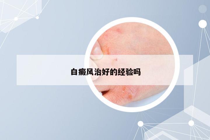 白癜风治好的经验吗