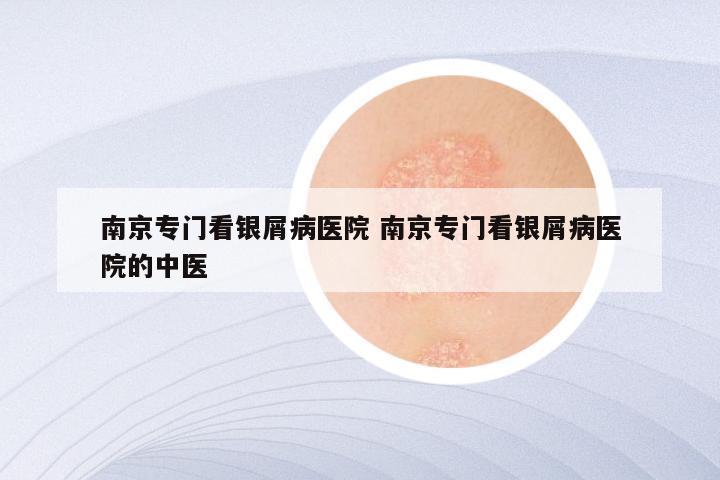 南京专门看银屑病医院 南京专门看银屑病医院的中医