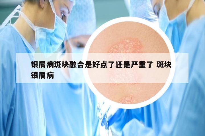 银屑病斑块融合是好点了还是严重了 斑块 银屑病