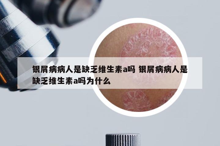 银屑病病人是缺乏维生素a吗 银屑病病人是缺乏维生素a吗为什么