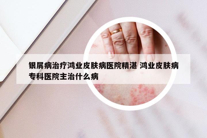 银屑病治疗鸿业皮肤病医院精湛 鸿业皮肤病专科医院主治什么病