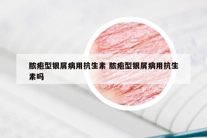 脓疱型银屑病用抗生素 脓疱型银屑病用抗生素吗