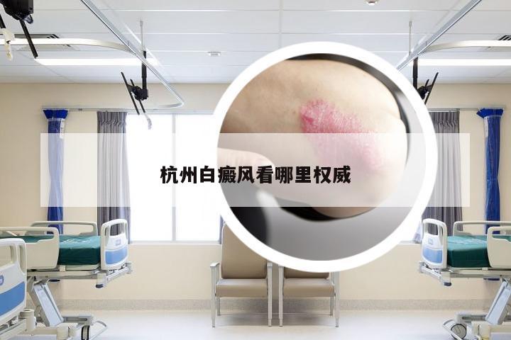 杭州白癜风看哪里权威