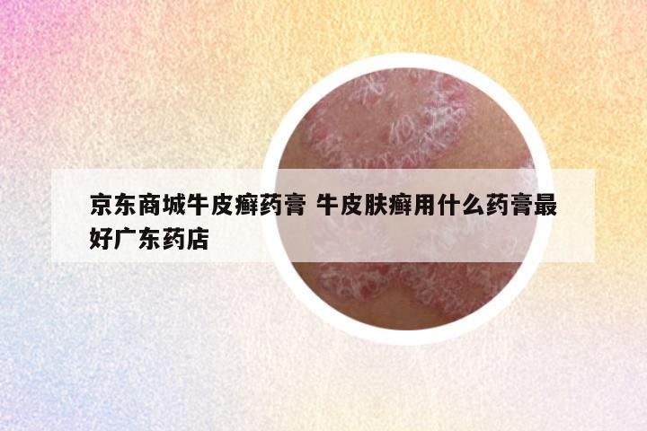 京东商城牛皮癣药膏 牛皮肤癣用什么药膏最好广东药店