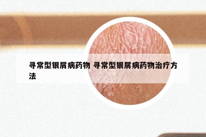 寻常型银屑病药物 寻常型银屑病药物治疗方法