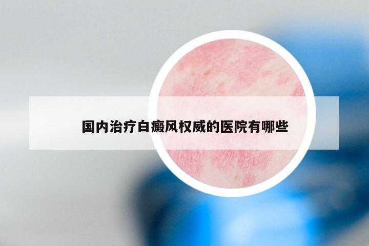 国内治疗白癜风权威的医院有哪些