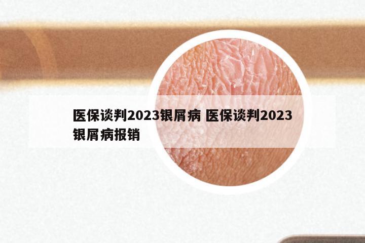 医保谈判2023银屑病 医保谈判2023银屑病报销