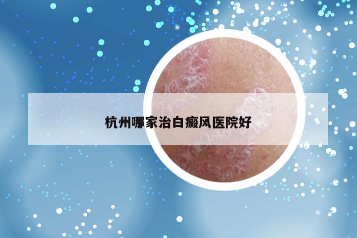 杭州哪家治白癜风医院好