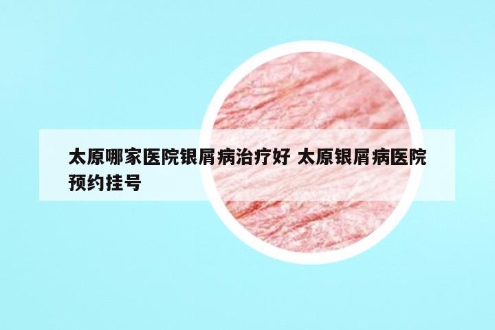 太原哪家医院银屑病治疗好 太原银屑病医院预约挂号