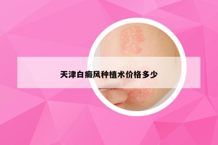 天津白癜风种植术价格多少