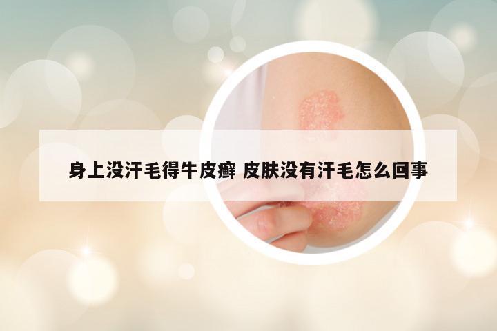 身上没汗毛得牛皮癣 皮肤没有汗毛怎么回事