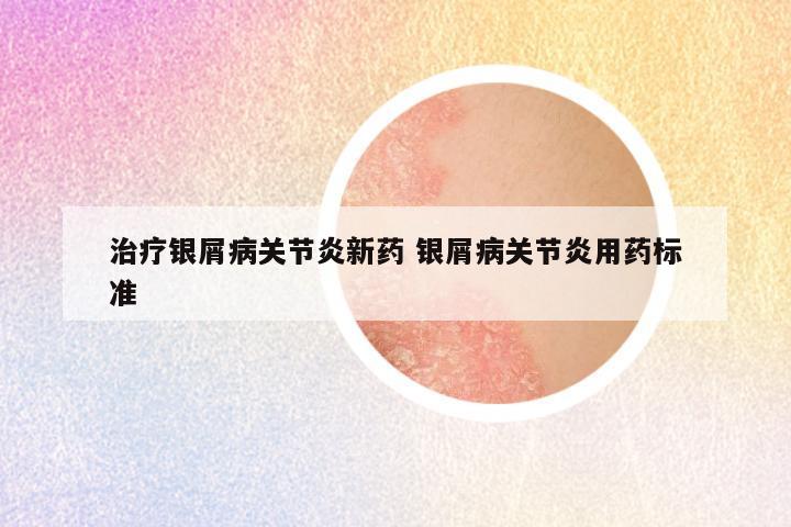 治疗银屑病关节炎新药 银屑病关节炎用药标准