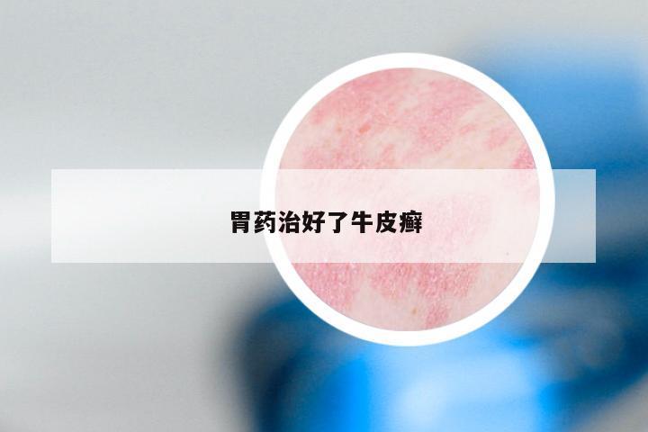 胃药治好了牛皮癣