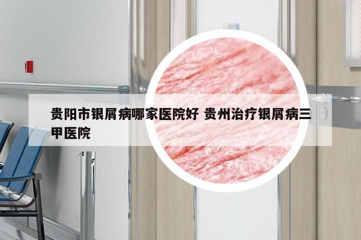 贵阳市银屑病哪家医院好 贵州治疗银屑病三甲医院