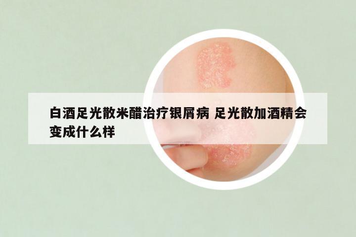 白酒足光散米醋治疗银屑病 足光散加酒精会变成什么样