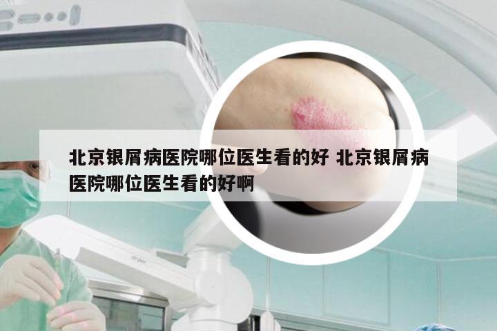 北京银屑病医院哪位医生看的好 北京银屑病医院哪位医生看的好啊