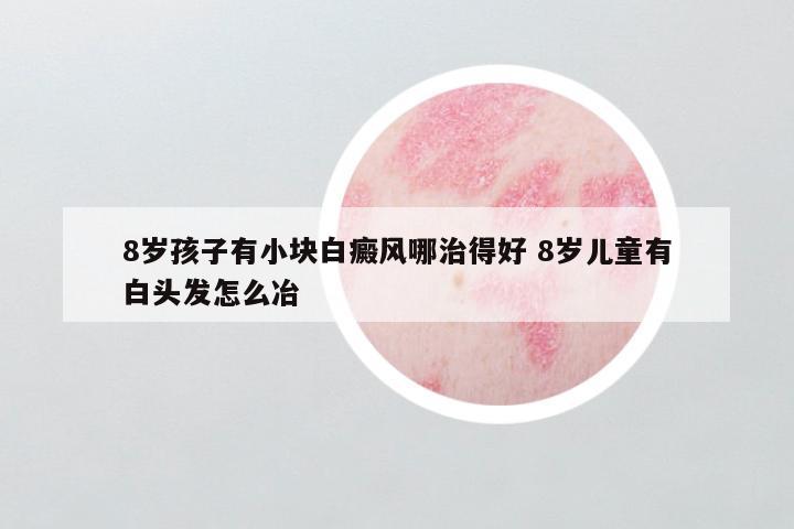 8岁孩子有小块白癜风哪治得好 8岁儿童有白头发怎么冶
