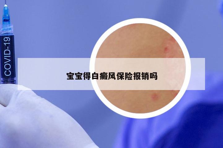 宝宝得白癜风保险报销吗