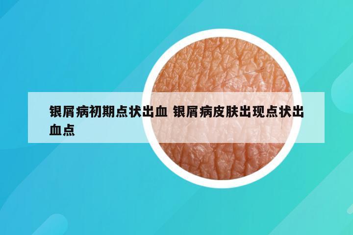 银屑病初期点状出血 银屑病皮肤出现点状出血点