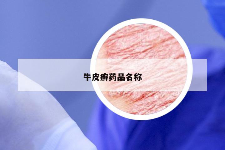 牛皮癣药品名称