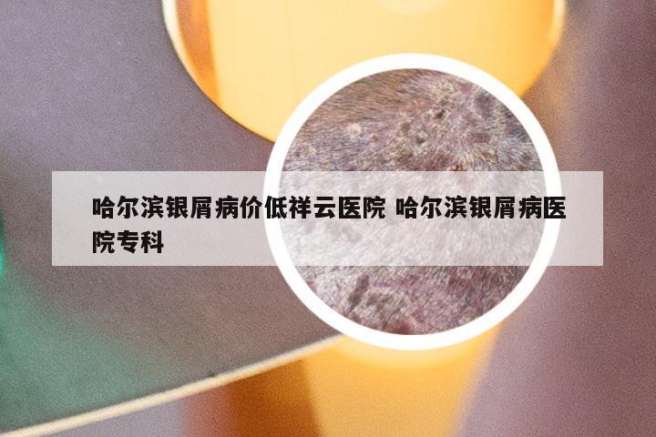 哈尔滨银屑病价低祥云医院 哈尔滨银屑病医院专科
