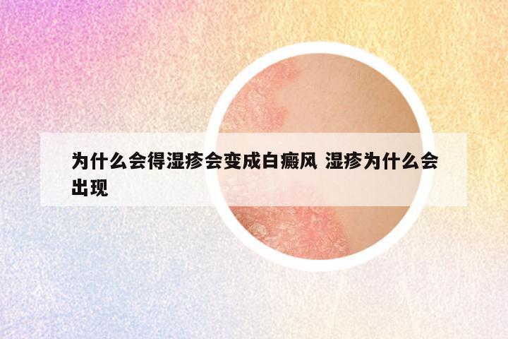 为什么会得湿疹会变成白癜风 湿疹为什么会出现