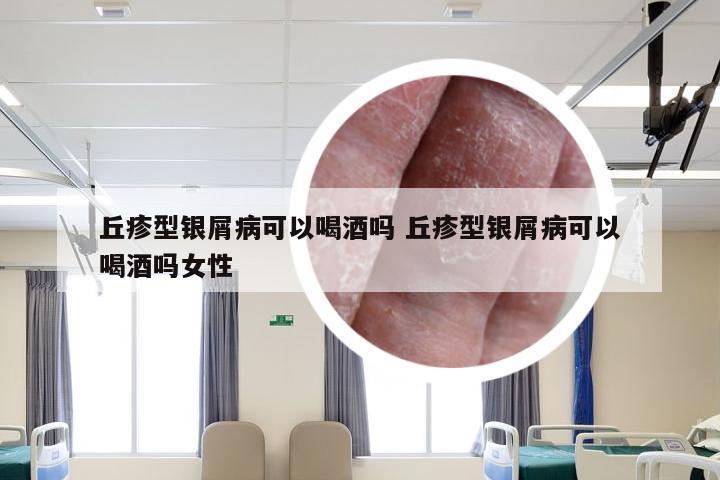 丘疹型银屑病可以喝酒吗 丘疹型银屑病可以喝酒吗女性