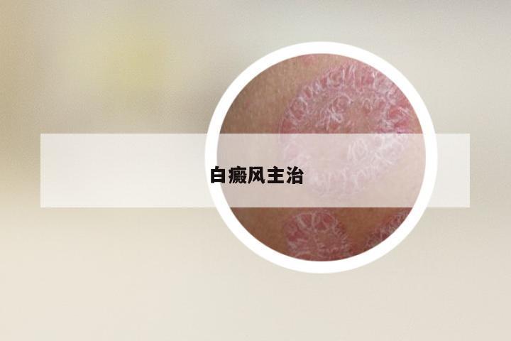 白癜风主治