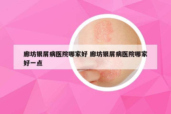 廊坊银屑病医院哪家好 廊坊银屑病医院哪家好一点