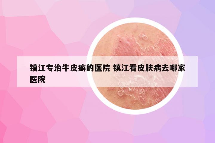 镇江专治牛皮癣的医院 镇江看皮肤病去哪家医院
