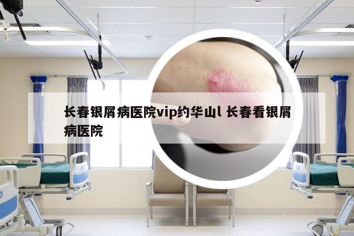 长春银屑病医院vip约华山l 长春看银屑病医院