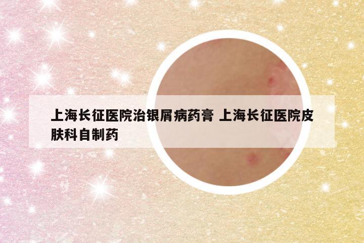 上海长征医院治银屑病药膏 上海长征医院皮肤科自制药