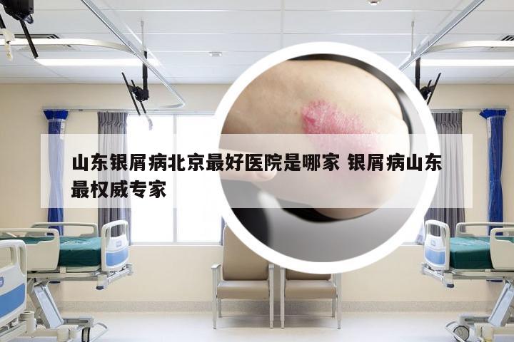 山东银屑病北京最好医院是哪家 银屑病山东最权威专家