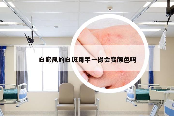 白癜风的白斑用手一撮会变颜色吗
