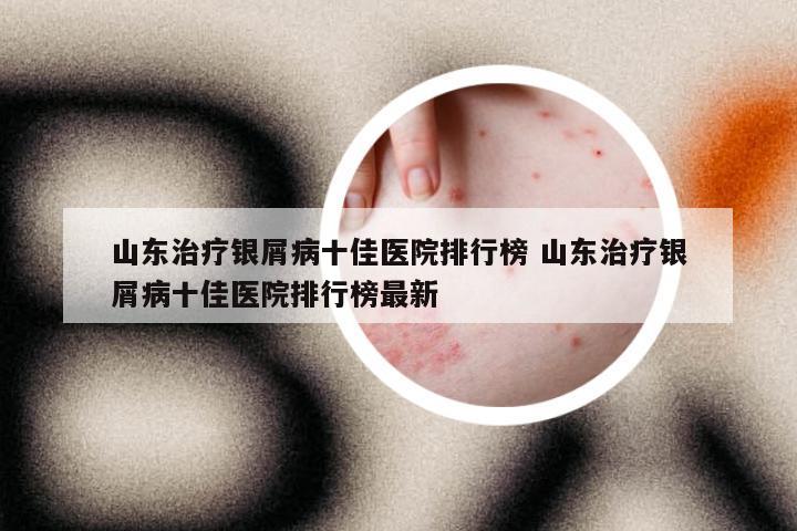 山东治疗银屑病十佳医院排行榜 山东治疗银屑病十佳医院排行榜最新