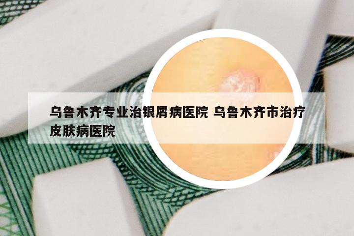 乌鲁木齐专业治银屑病医院 乌鲁木齐市治疗皮肤病医院