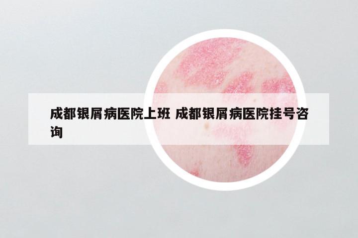 成都银屑病医院上班 成都银屑病医院挂号咨询