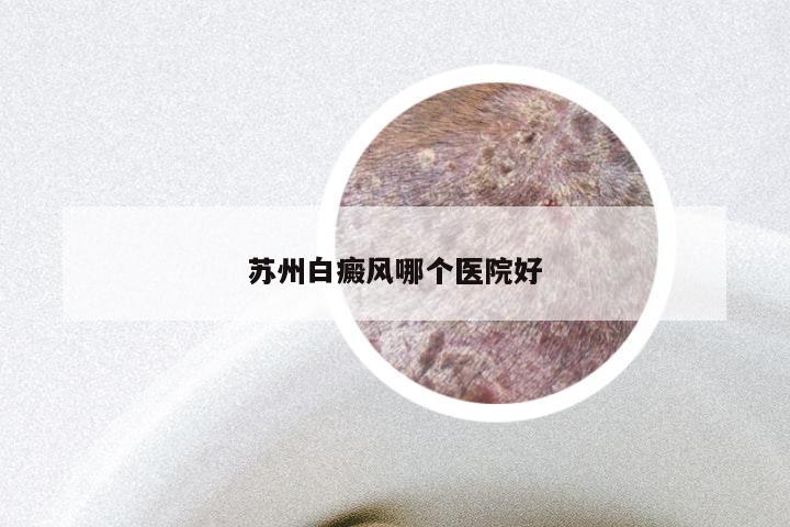苏州白癜风哪个医院好