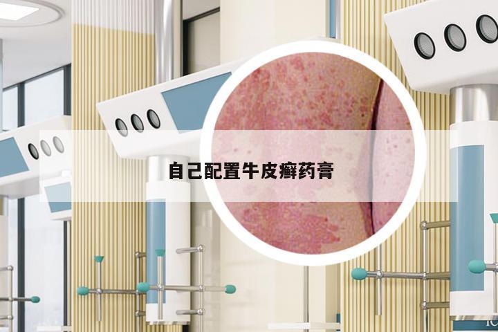 自己配置牛皮癣药膏
