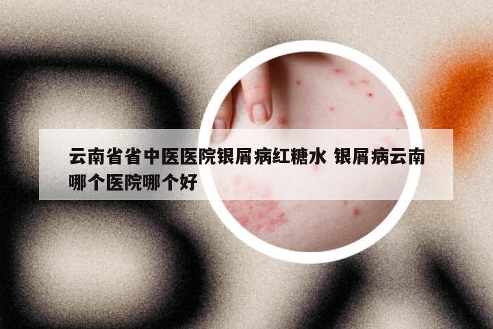 云南省省中医医院银屑病红糖水 银屑病云南哪个医院哪个好
