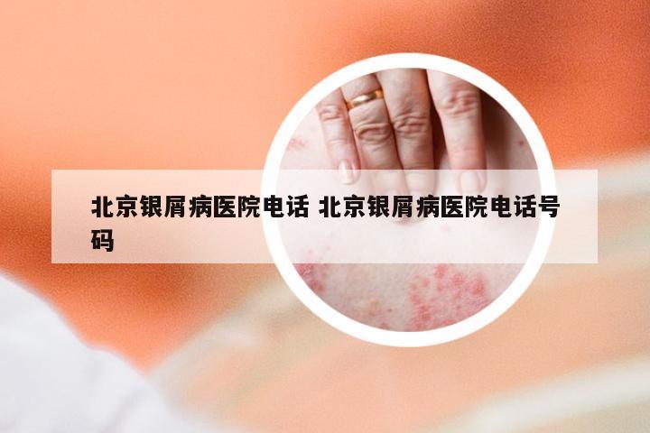 北京银屑病医院电话 北京银屑病医院电话号码