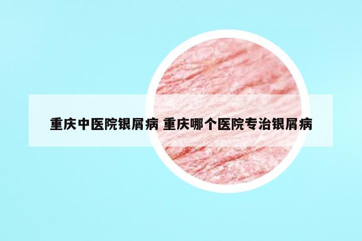 重庆中医院银屑病 重庆哪个医院专治银屑病