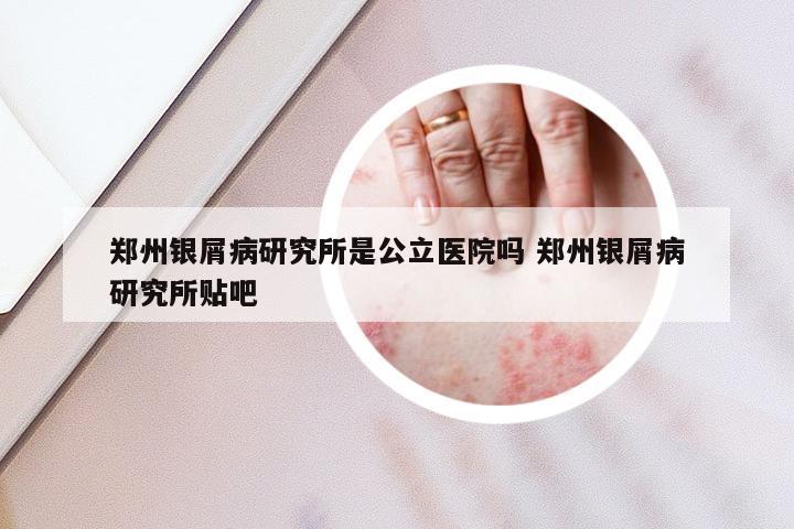 郑州银屑病研究所是公立医院吗 郑州银屑病研究所贴吧