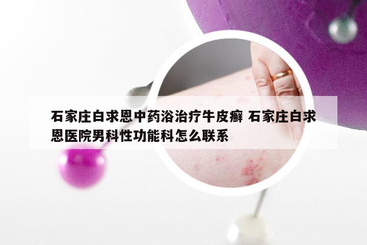 石家庄白求恩中药浴治疗牛皮癣 石家庄白求恩医院男科性功能科怎么联系