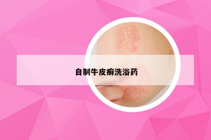 自制牛皮癣洗浴药