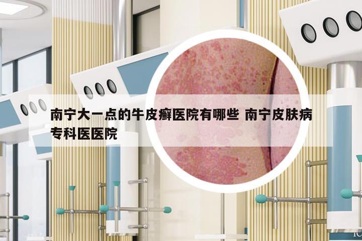 南宁大一点的牛皮癣医院有哪些 南宁皮肤病专科医医院